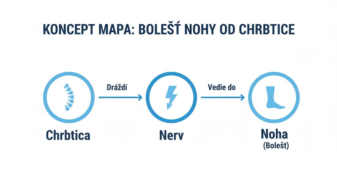 Konceptuálna mapa zobrazujúca, ako problémy s chrbticou dráždia nervy, čo vedie k bolesti v nohe.