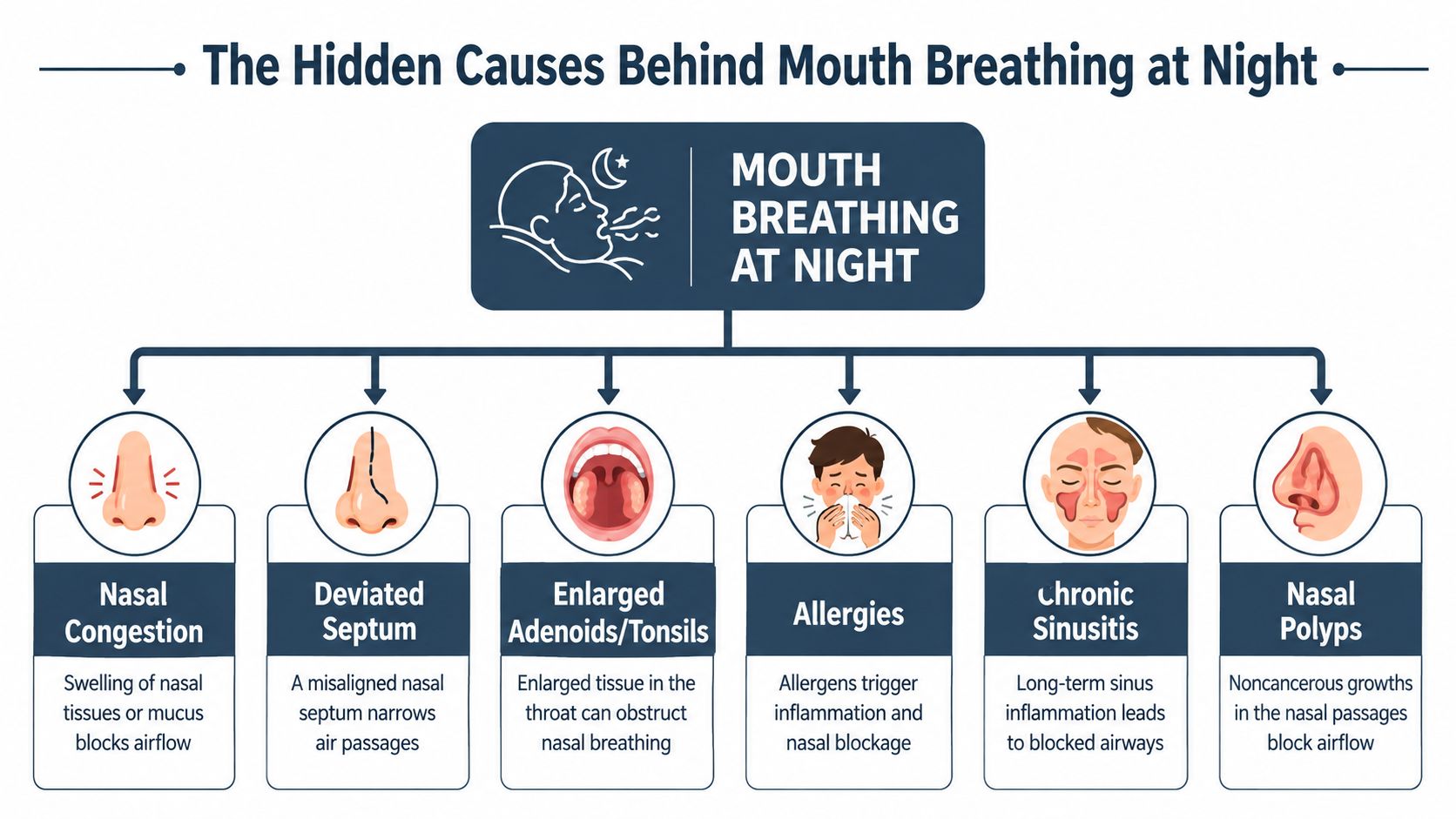 A diagram illustrating six primary medical causes for mouth breathing while sleeping at night.