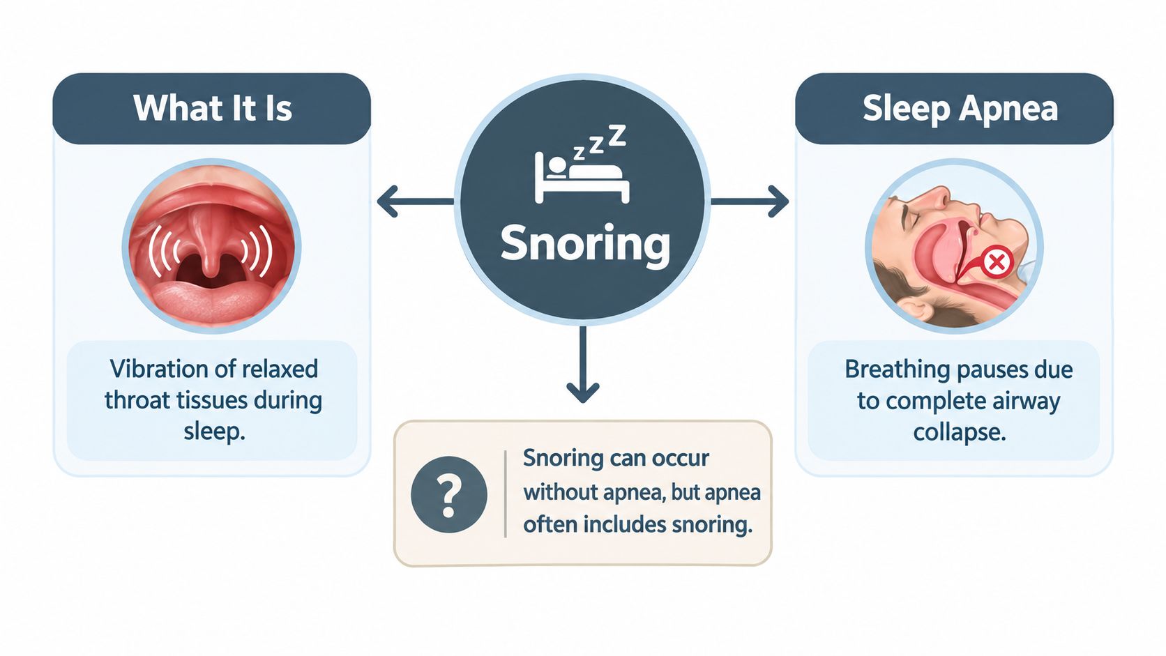 A diagram comparing snoring, which involves vibrating throat tissues, to sleep apnea, characterized by airway collapse.