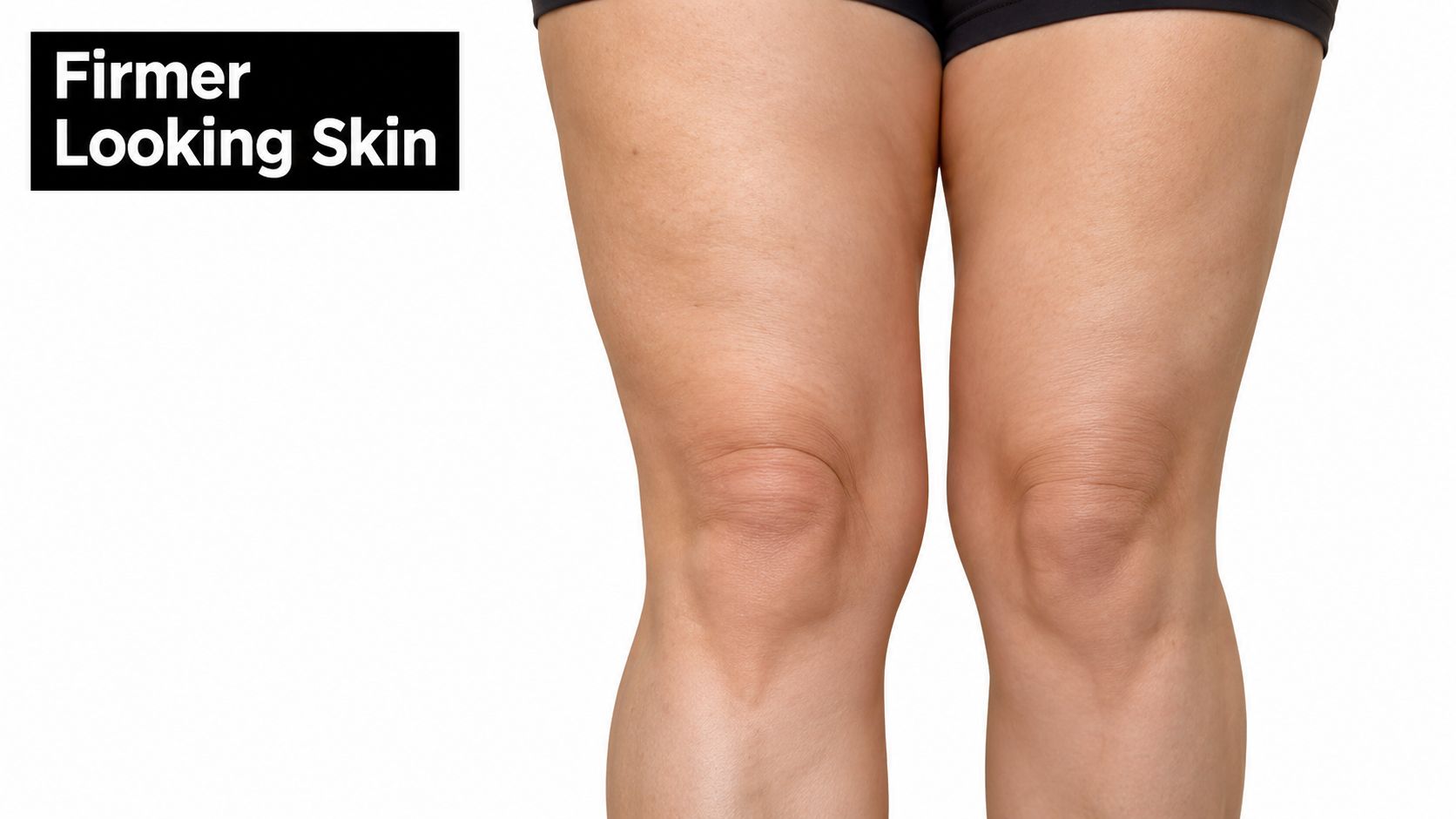 A close-up view of human legs highlighting skin texture with the text overlay Firmer Looking Skin.