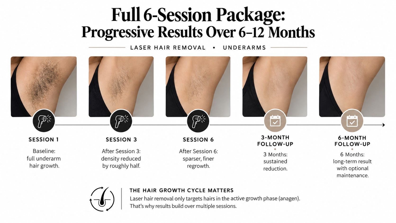 A visual timeline showing progressive hair reduction results on underarms over a 6-session laser hair removal package.