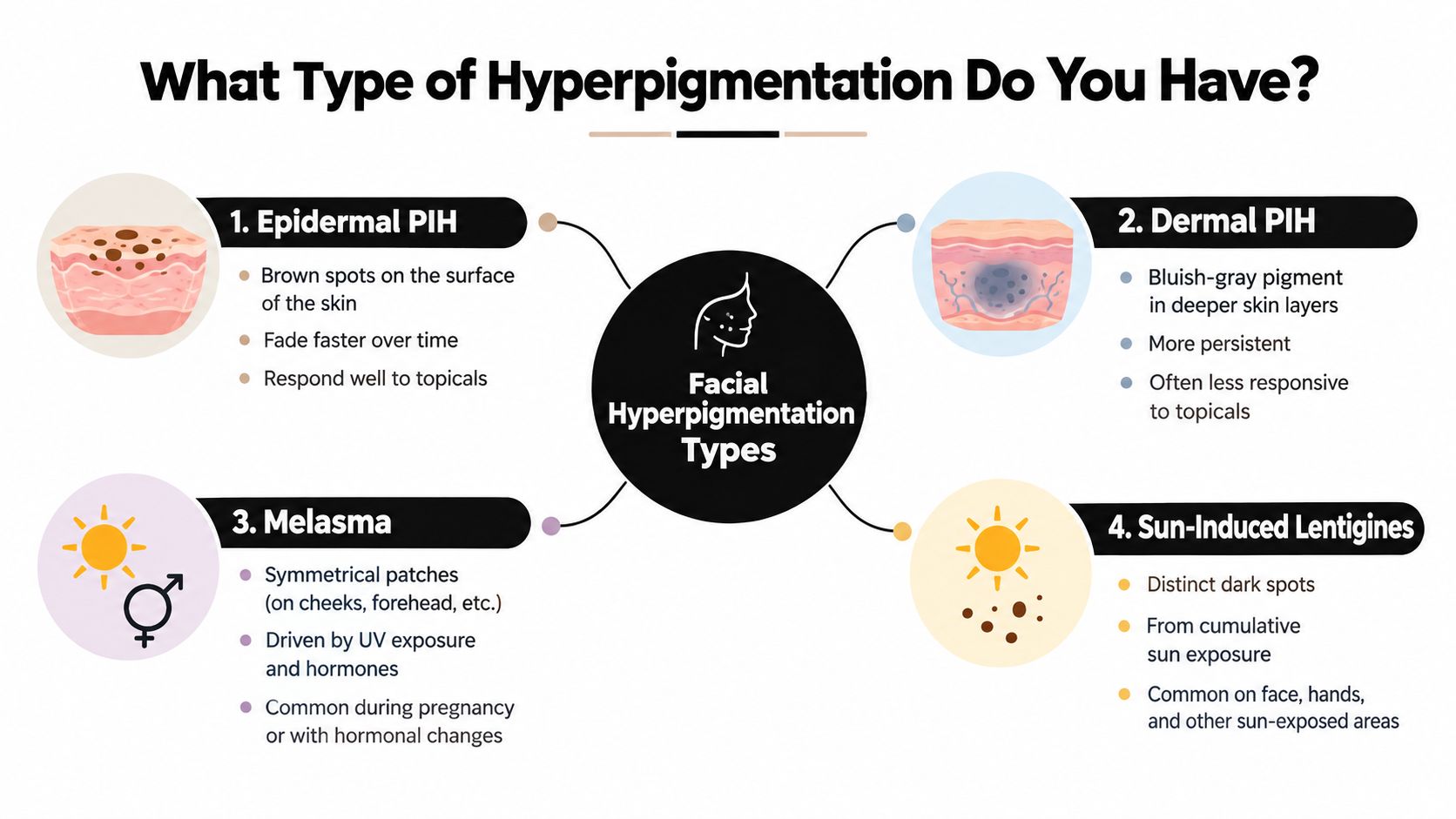 An infographic titled What Type of Hyperpigmentation Do You Have explaining four common types of facial pigment.