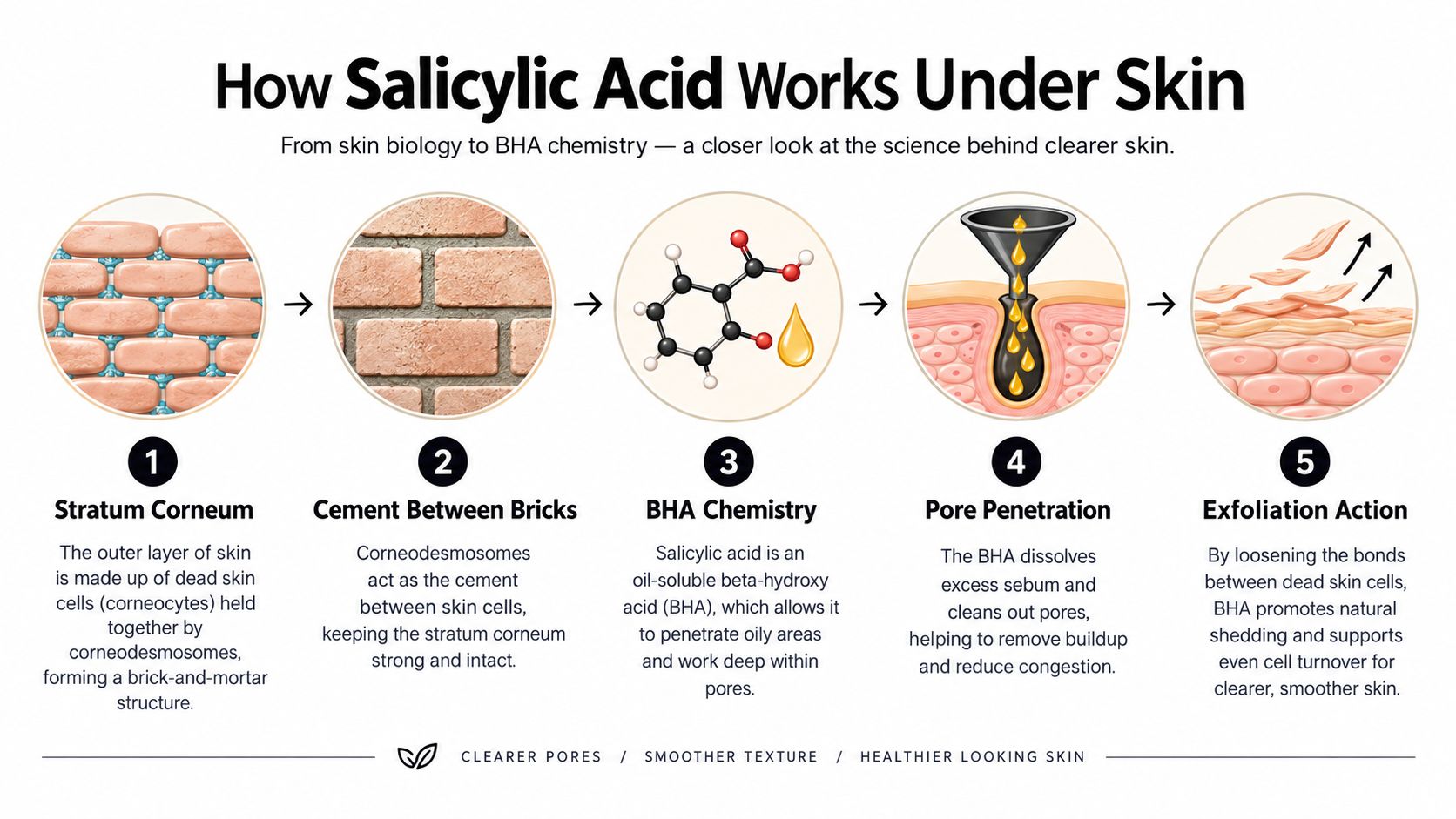 A five-step infographic explaining how salicylic acid works to penetrate pores and exfoliate dead skin cells.