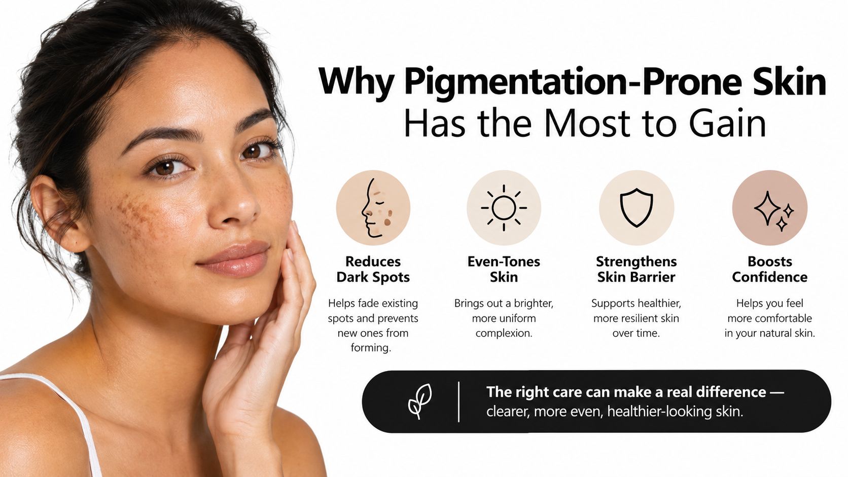 A woman with skin pigmentation looking at the camera, showing benefits of skincare for even-toned skin.