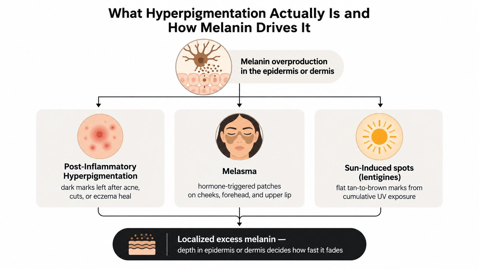 A diagram explaining how melanin overproduction leads to post-inflammatory hyperpigmentation, melasma, and sun-induced spots on skin.