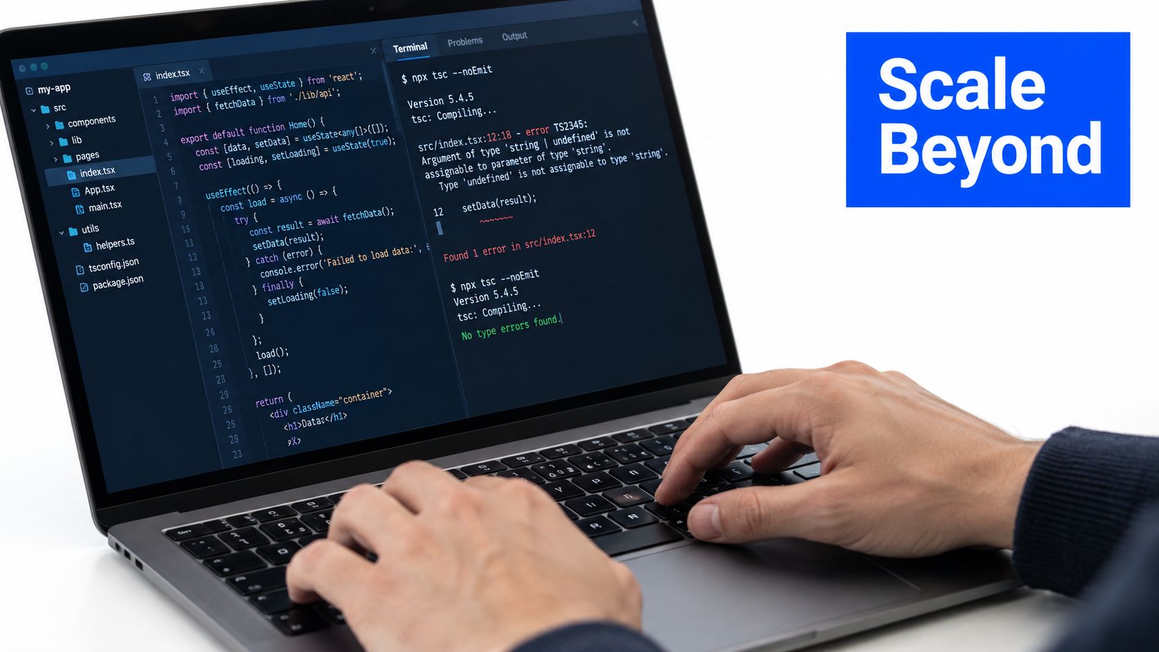 A developer typing code on a laptop screen showing a TypeScript error in an IDE terminal.