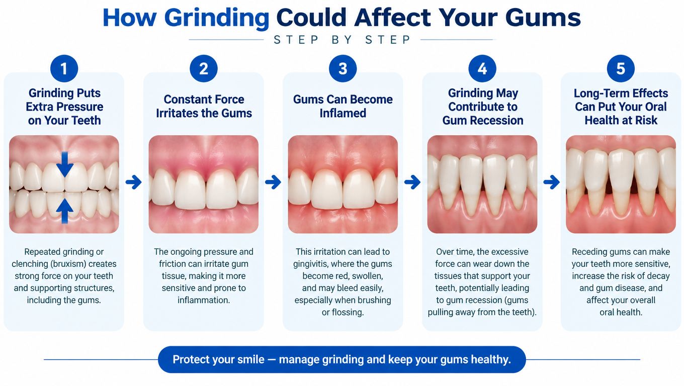 A step-by-step infographic illustrating how teeth grinding, known as bruxism, can lead to gum recession.