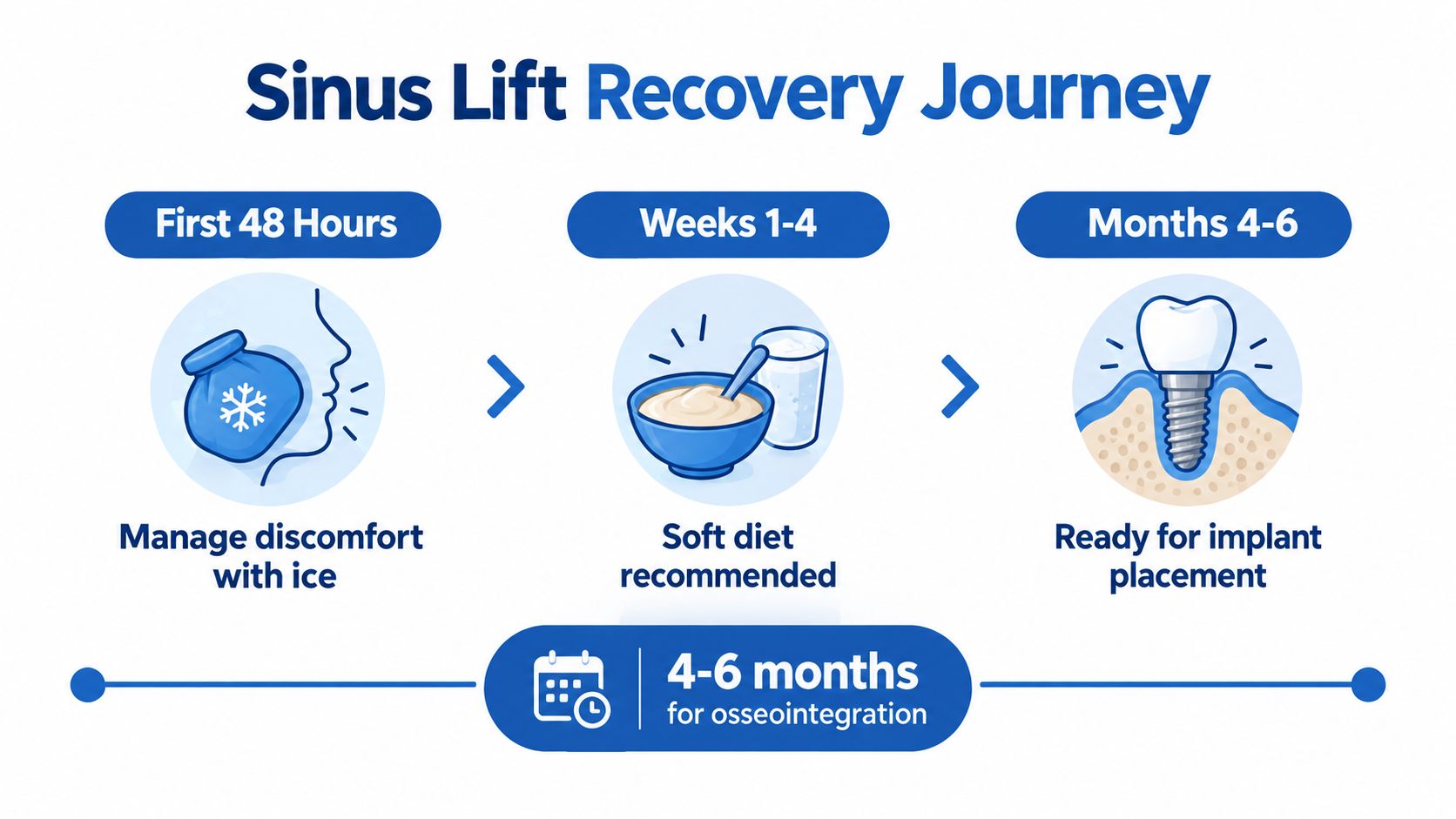 An infographic illustrating the sinus lift recovery journey timeline from the first 48 hours to months 4-6.