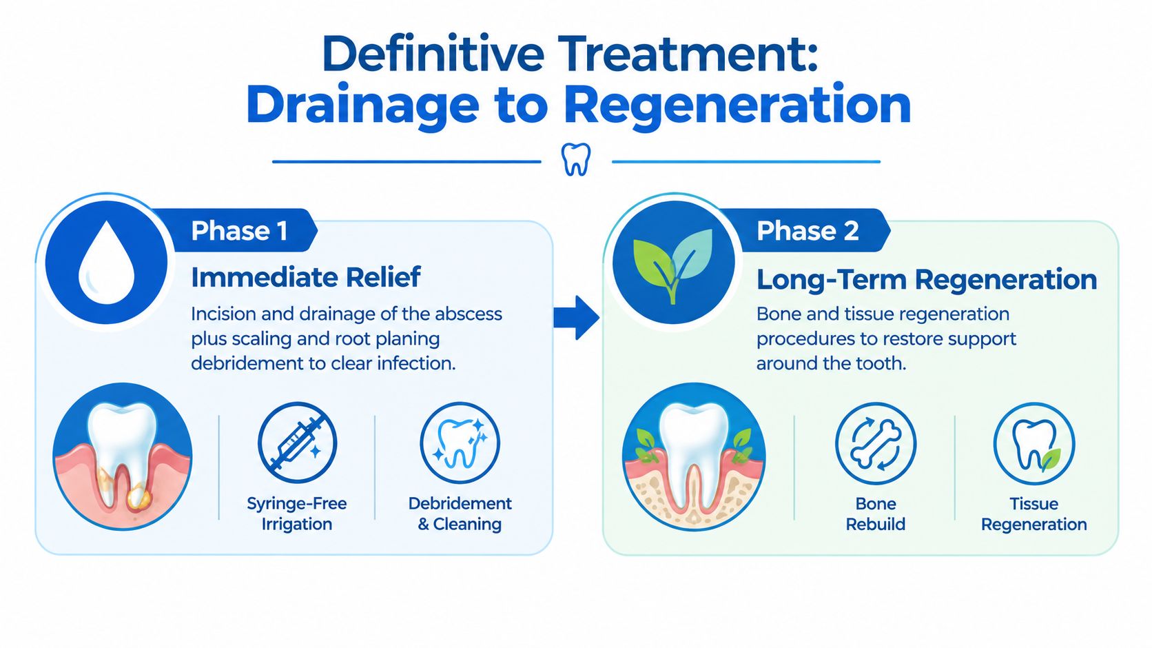 A dental infographic showing two treatment phases for a periodontal gum abscess: drainage and long-term tissue regeneration.