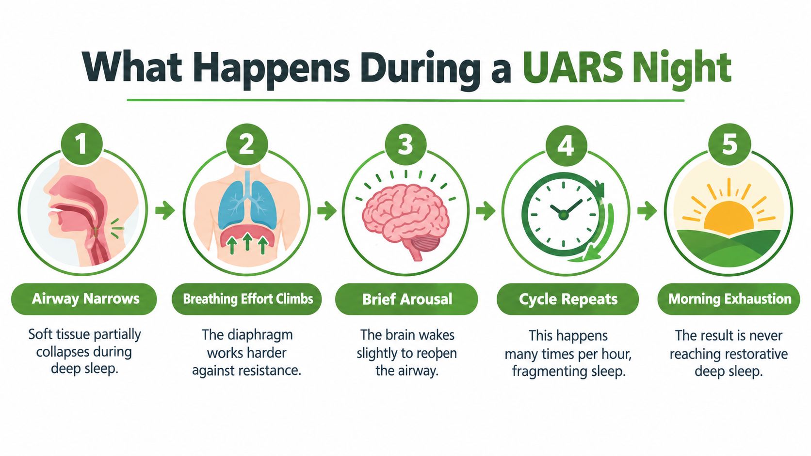 A five-step infographic explaining the cycle of Upper Airway Resistance Syndrome (UARS) during sleep.