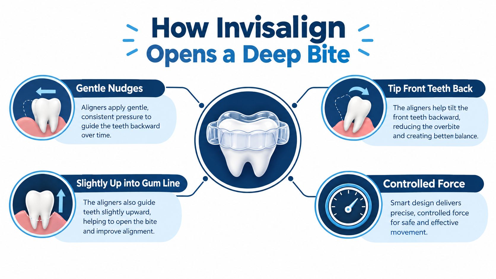 An infographic showing how Invisalign aligners use controlled force to correct a deep bite dental condition.