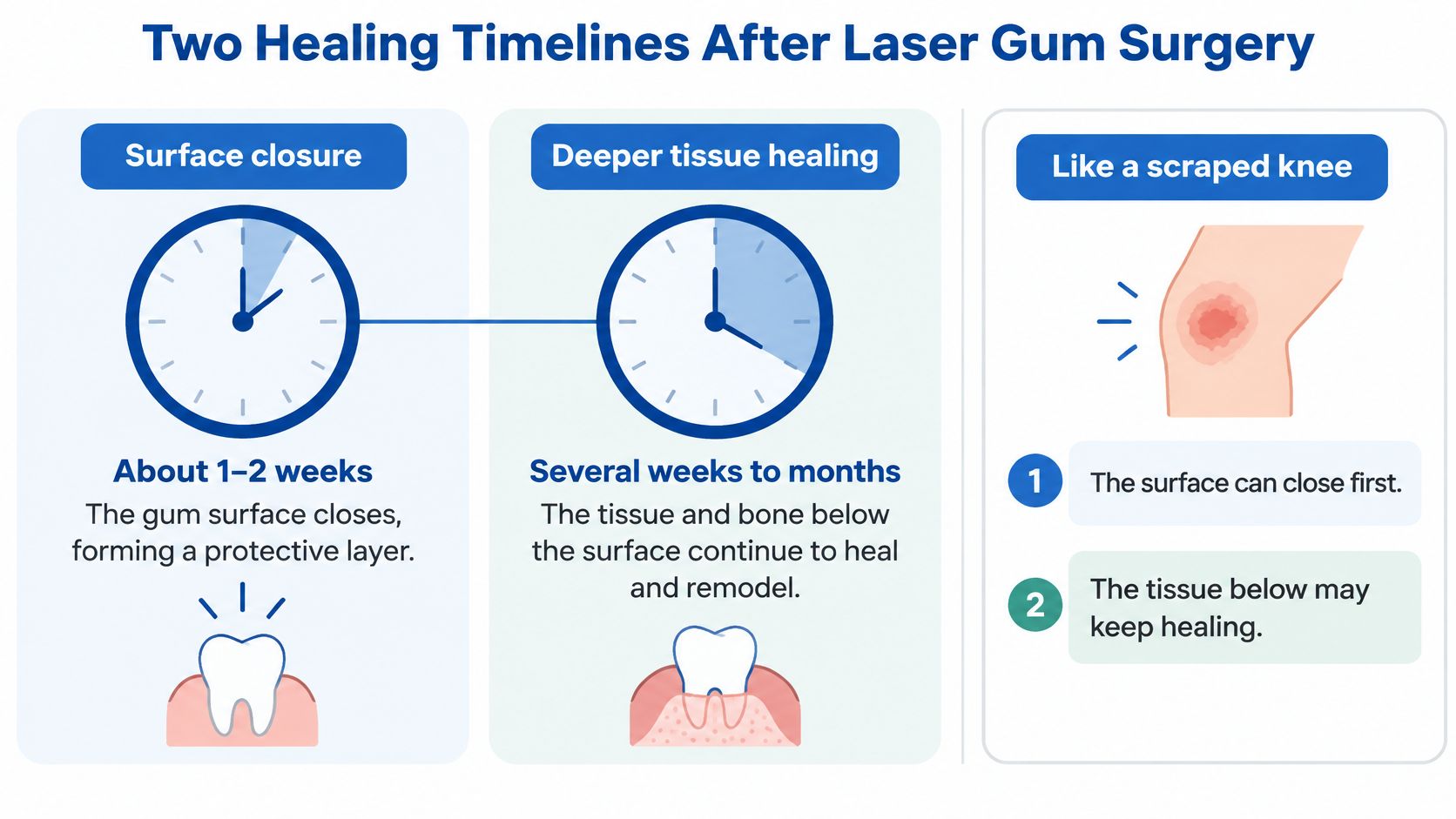 A diagram explaining the two stages of healing timelines after laser gum surgery, surface versus deep tissue.