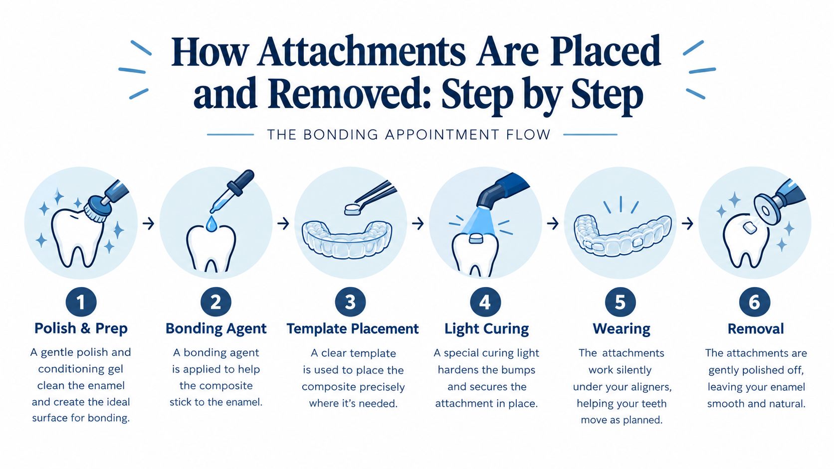 An infographic detailing the six-step process for placing and removing Invisalign dental attachments on teeth.