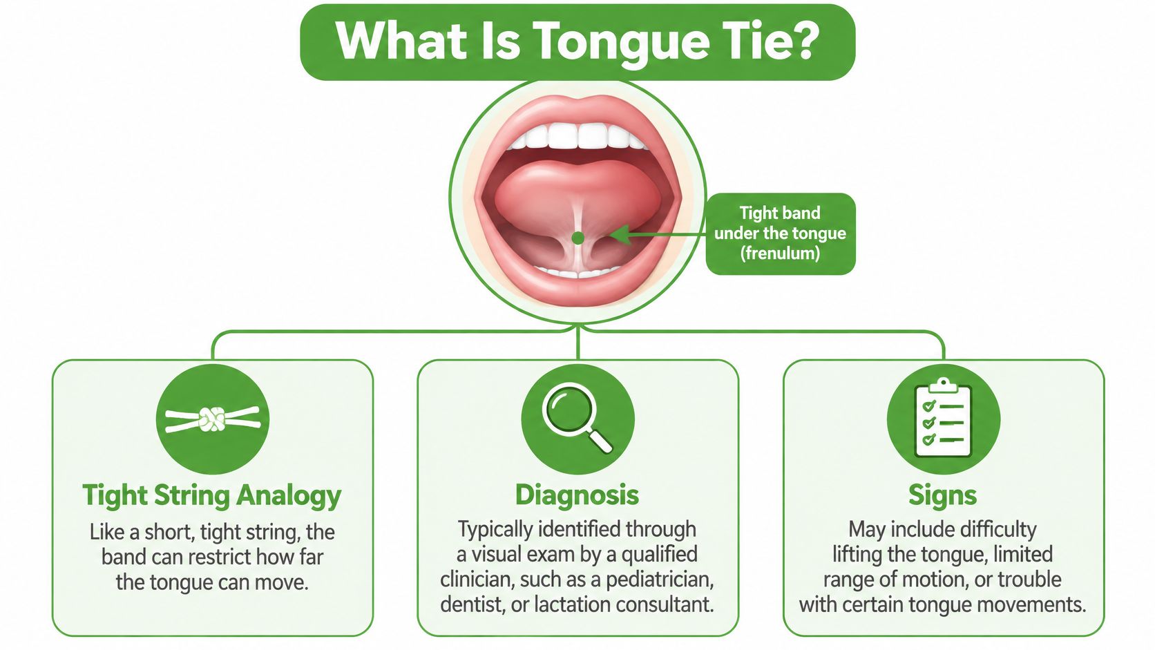 An infographic explaining tongue tie with a mouth diagram, identifying the frenulum, diagnosis, and common signs.