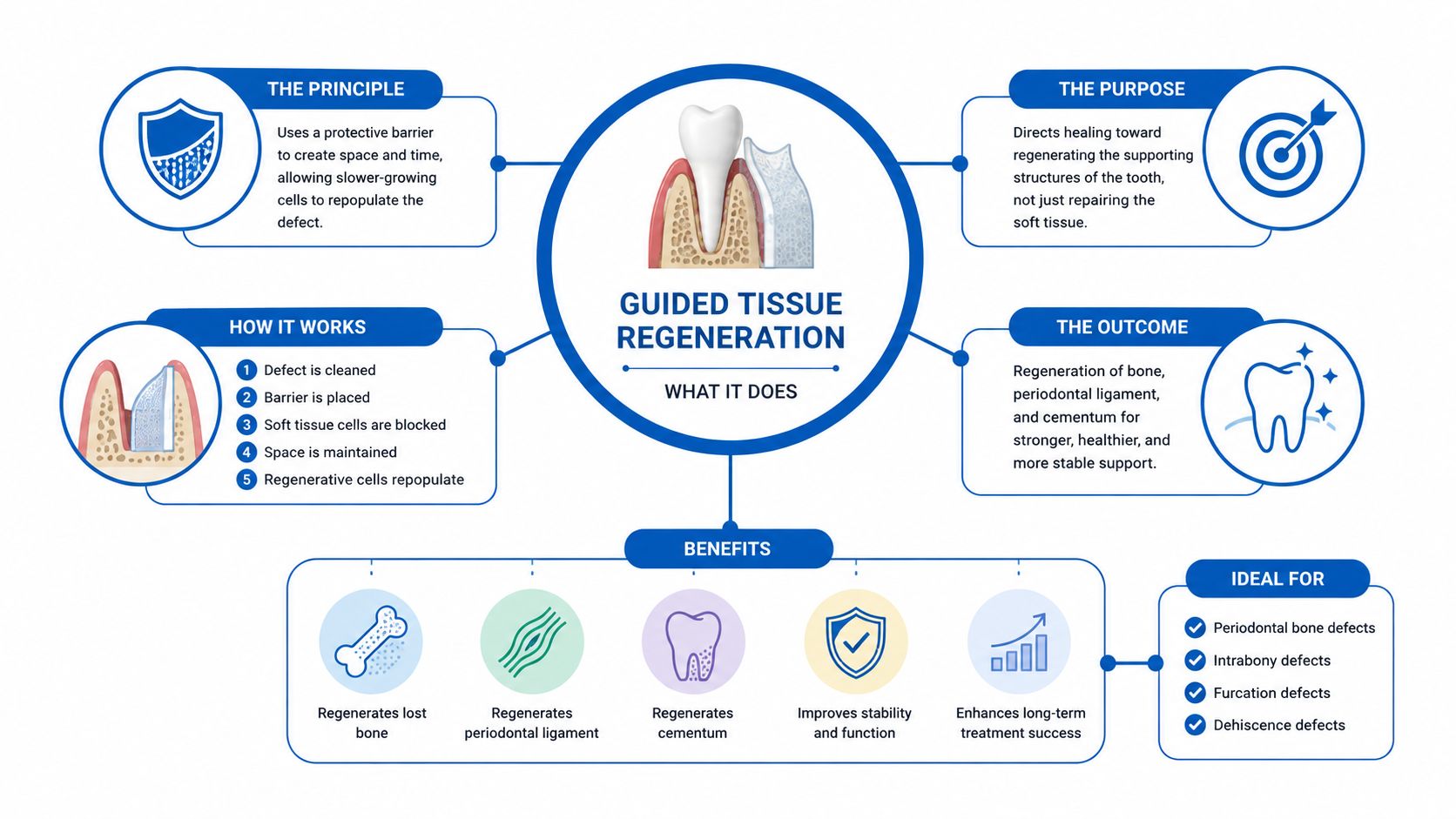 A detailed infographic explaining guided tissue regeneration, covering the principle, purpose, process, benefits, and common dental applications.