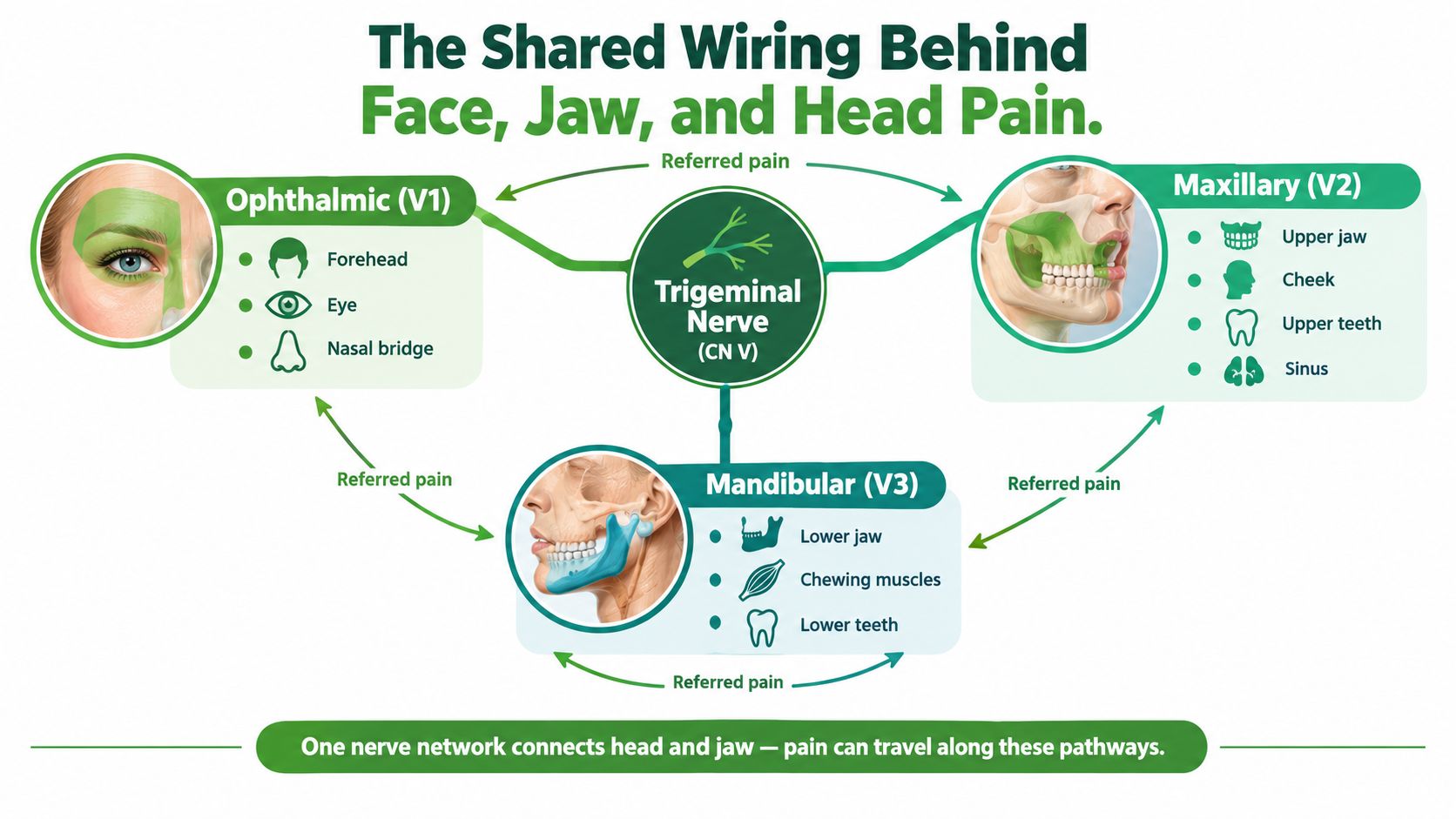 An infographic showing the three branches of the trigeminal nerve and how pain radiates across the face.