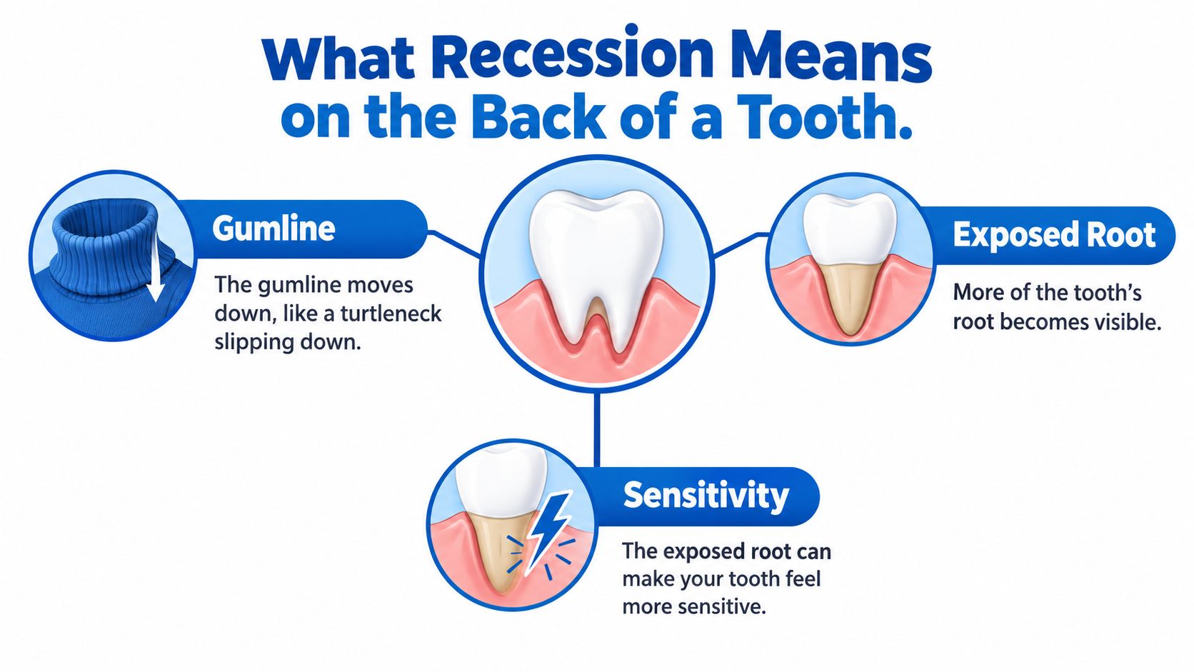 A diagram explaining how gum recession occurs, showing the gumline lowering and resulting in root exposure and sensitivity.