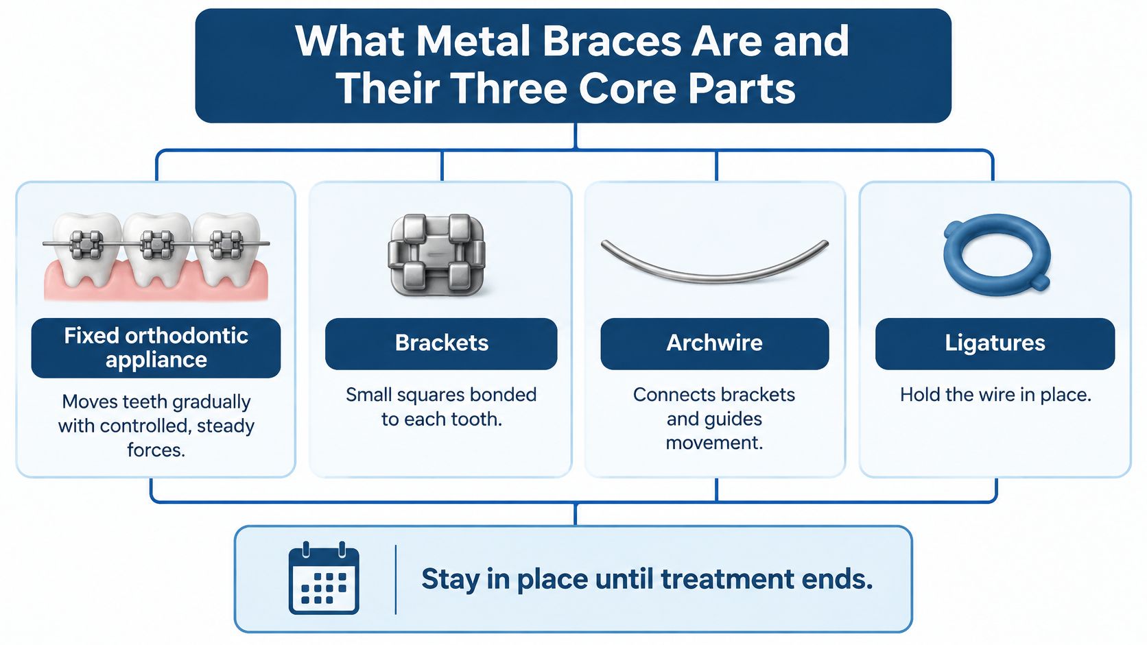 A diagram explaining metal braces, including brackets, archwire, and ligatures, and their role in teeth movement.