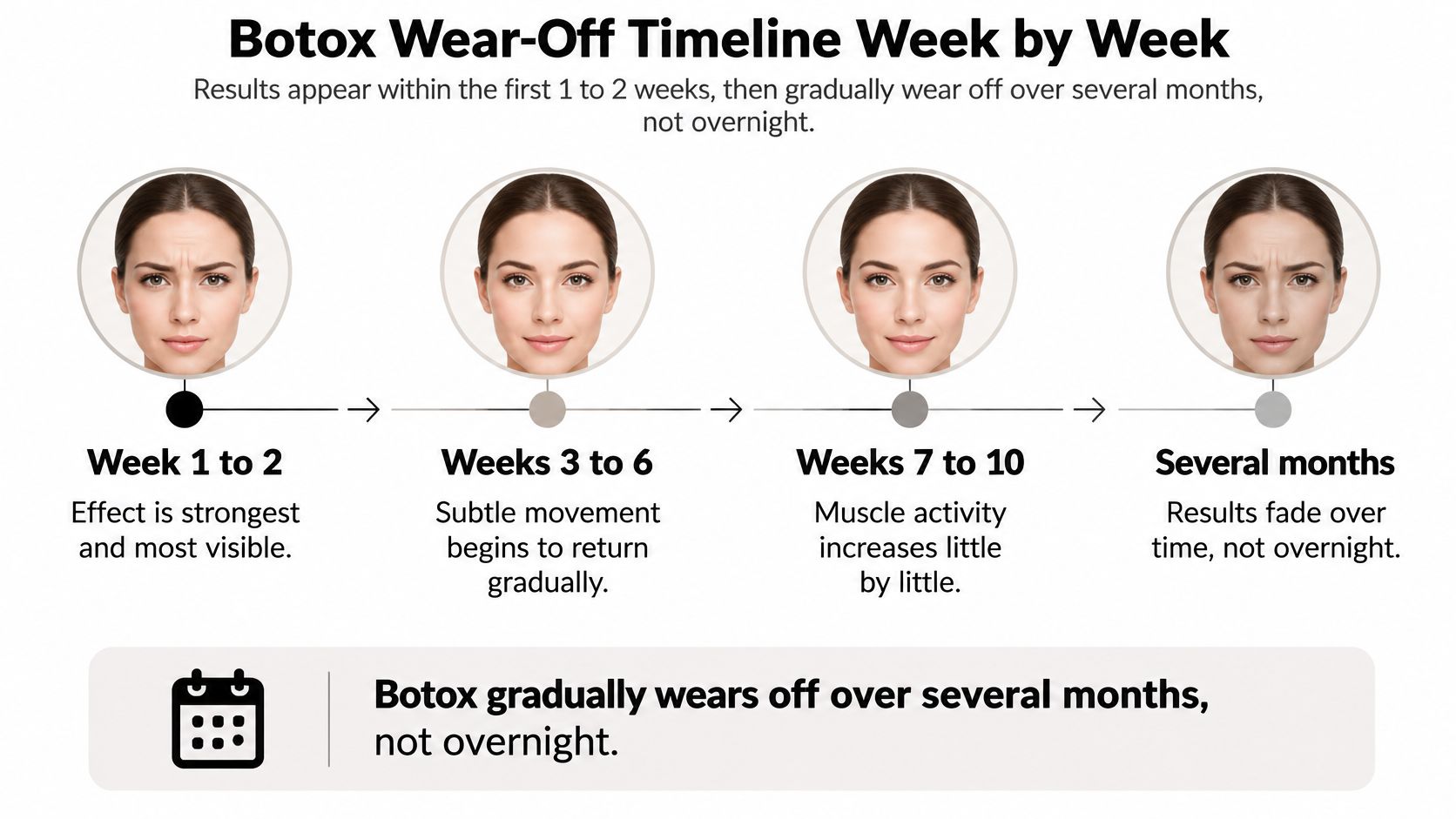 An infographic showing the Botox wear-off timeline, explaining how muscle activity returns gradually over several months.
