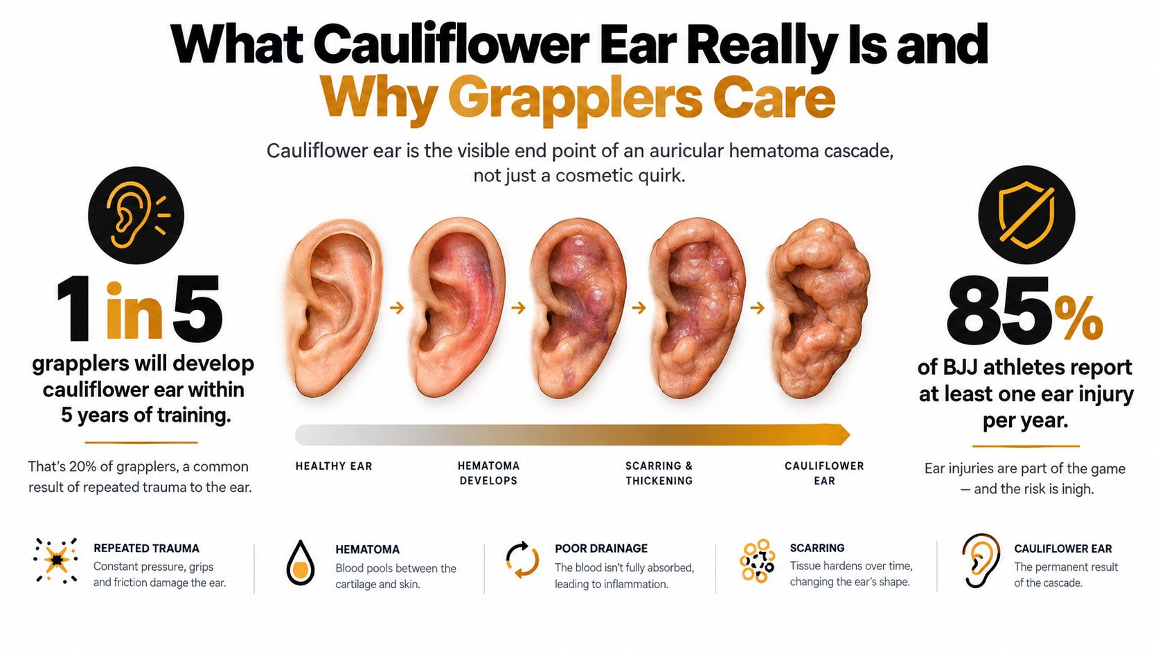 An infographic detailing the development stages of cauliflower ear in athletes, from healthy to scarred ear.