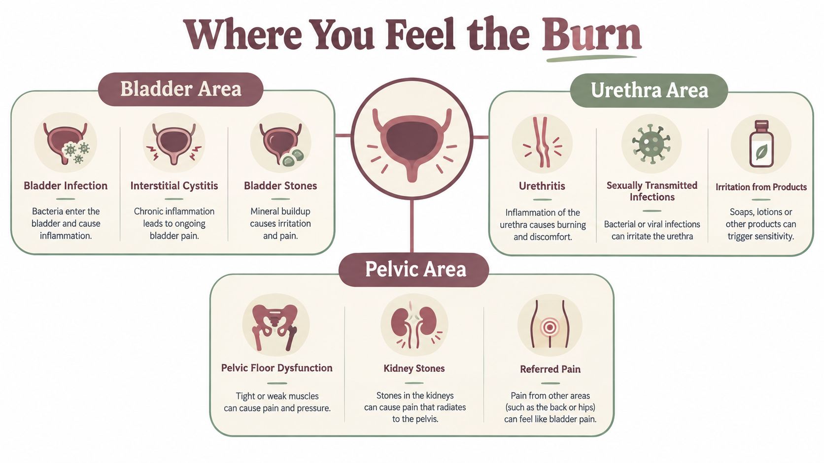 An infographic titled Where You Feel the Burn, detailing various causes of pain in the bladder, urethra, and pelvic area.