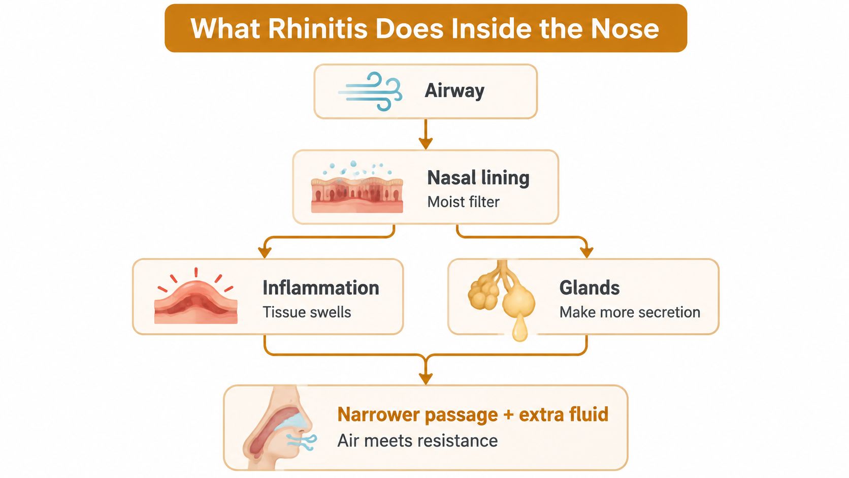 A diagram illustrating how rhinitis causes nasal inflammation, increased gland secretion, and obstructed breathing, leading to stuffiness.