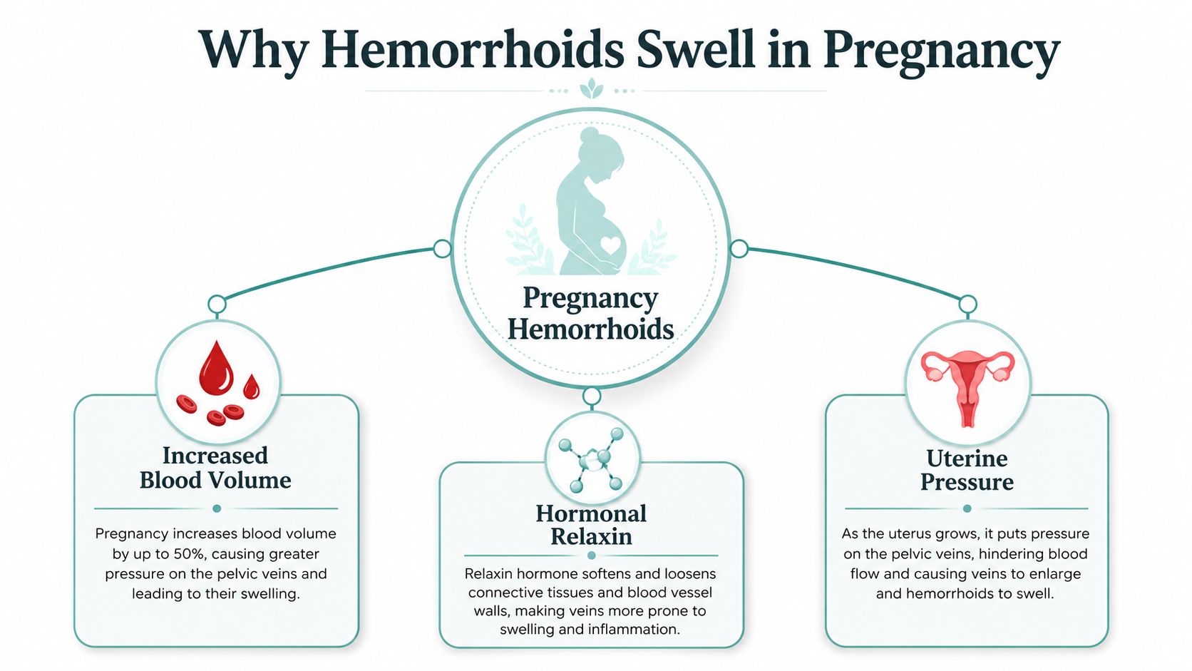 An infographic explaining three main causes of swollen hemorrhoids during pregnancy: increased blood volume, hormonal relaxin, and uterine pressure.