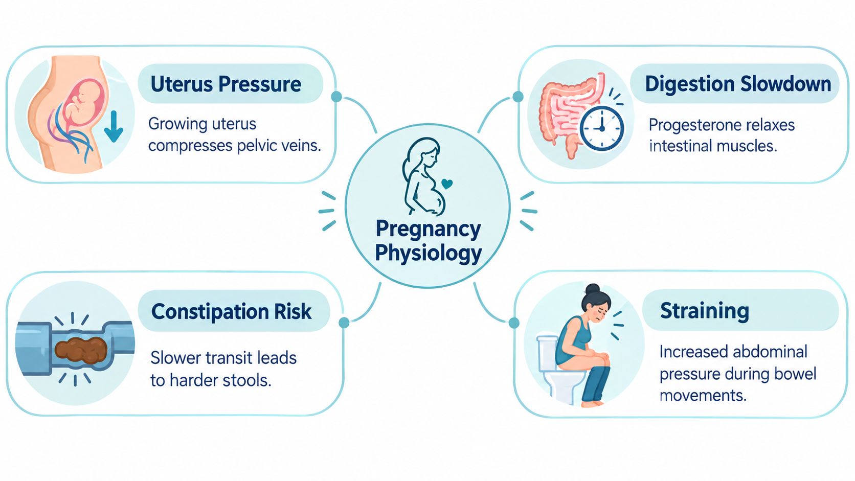 An infographic explaining how pregnancy physiology leads to hemorrhoids through pressure, slowed digestion, constipation, and straining.