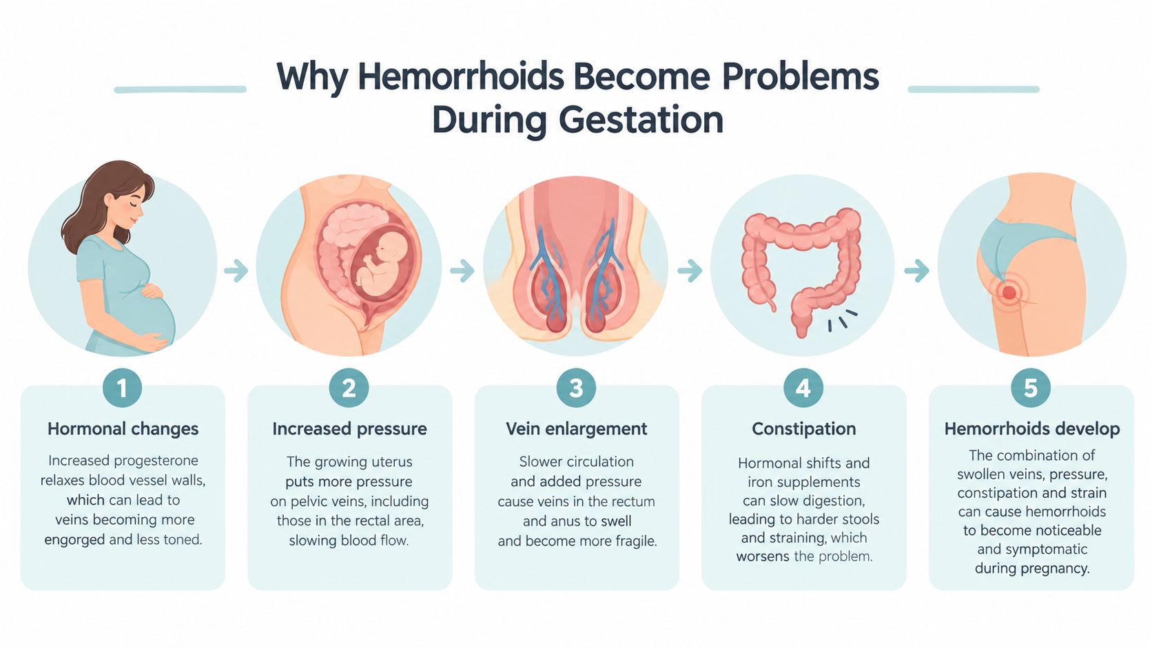 An infographic illustrating five steps explaining why hemorrhoids become a problem during pregnancy, including hormonal and physical changes.
