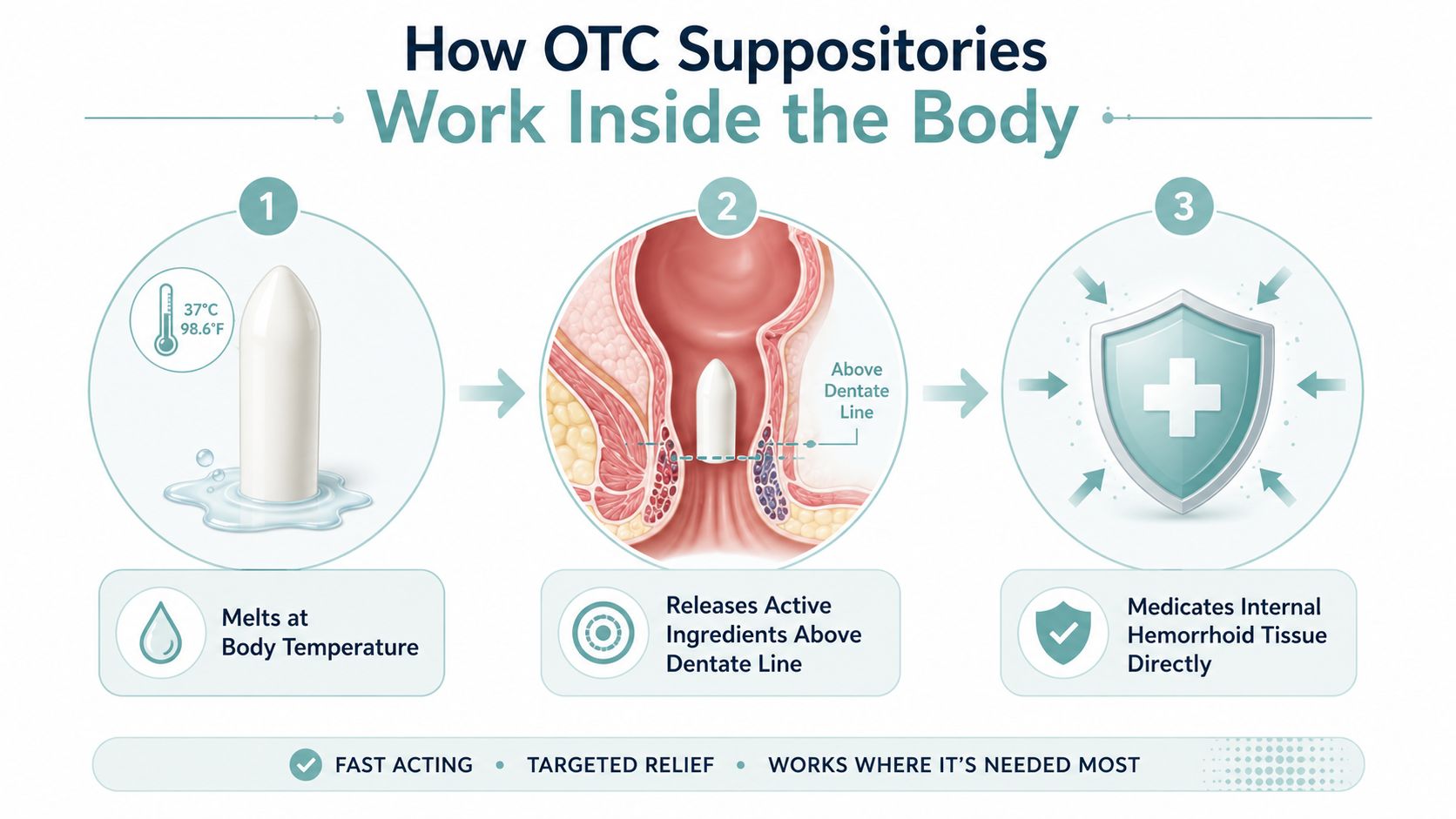 A diagram illustrating how an over-the-counter hemorrhoid suppository melts and treats internal tissues inside the body.