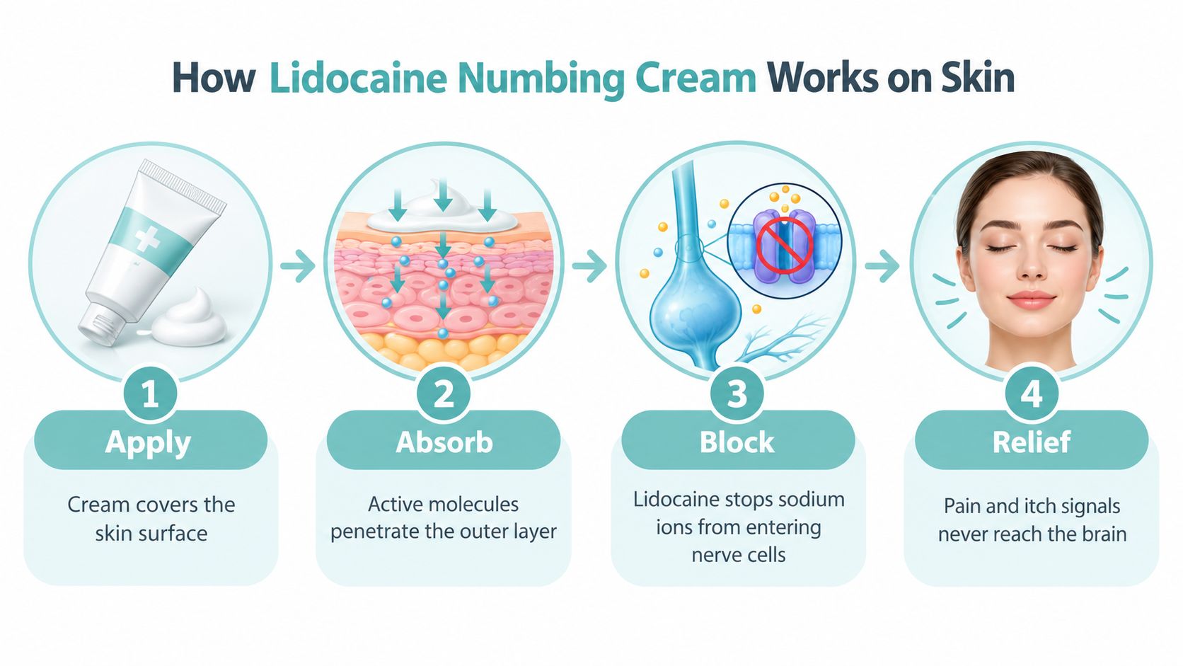 An infographic illustrating the four-step process of how lidocaine numbing cream works on the skin.