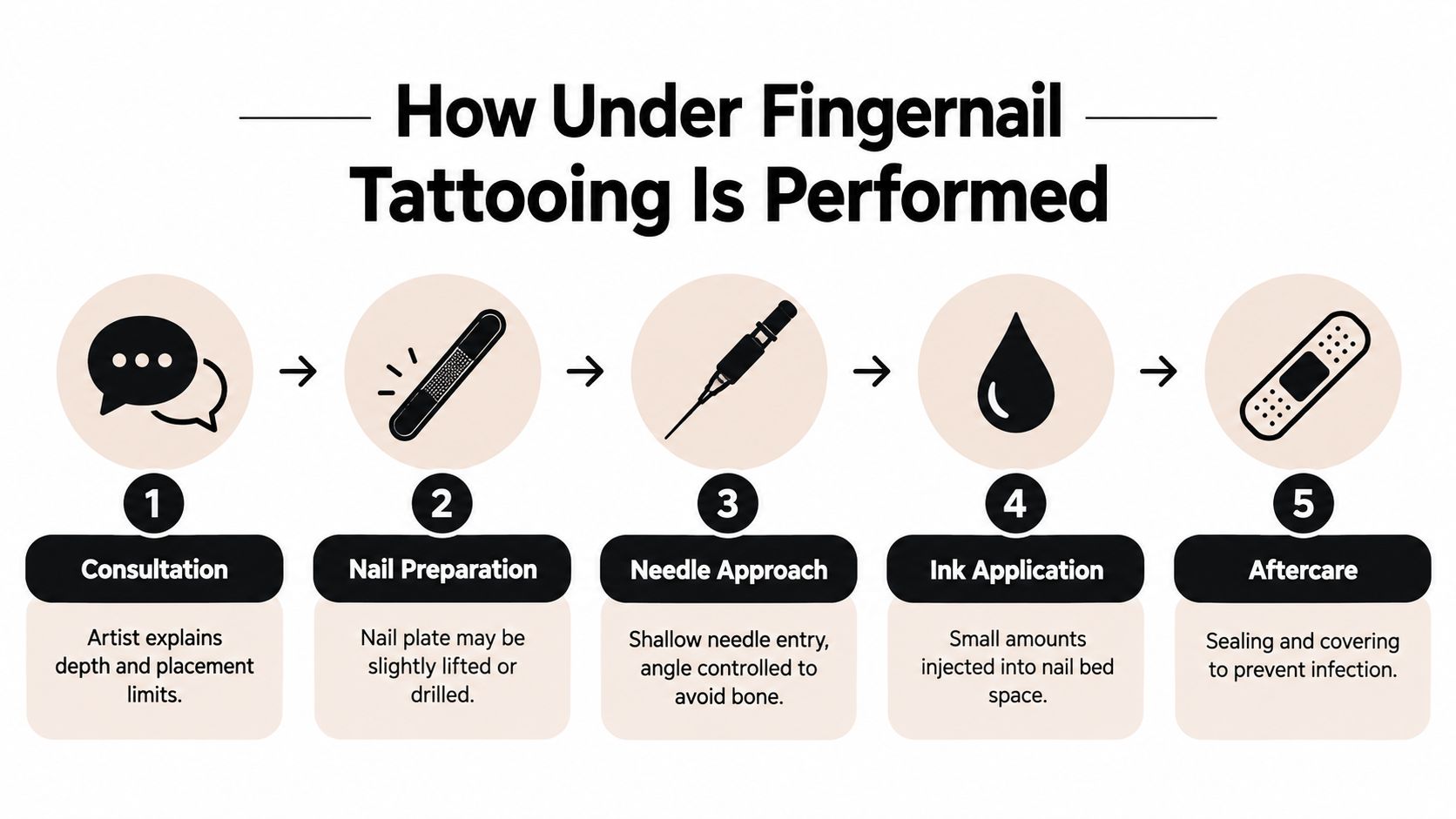 A five-step infographic showing the professional process of getting a tattoo under the fingernail.