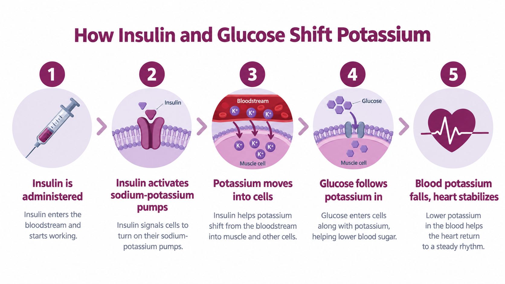 A five-step infographic illustrating how insulin and glucose administration shifts potassium from the bloodstream into cells.