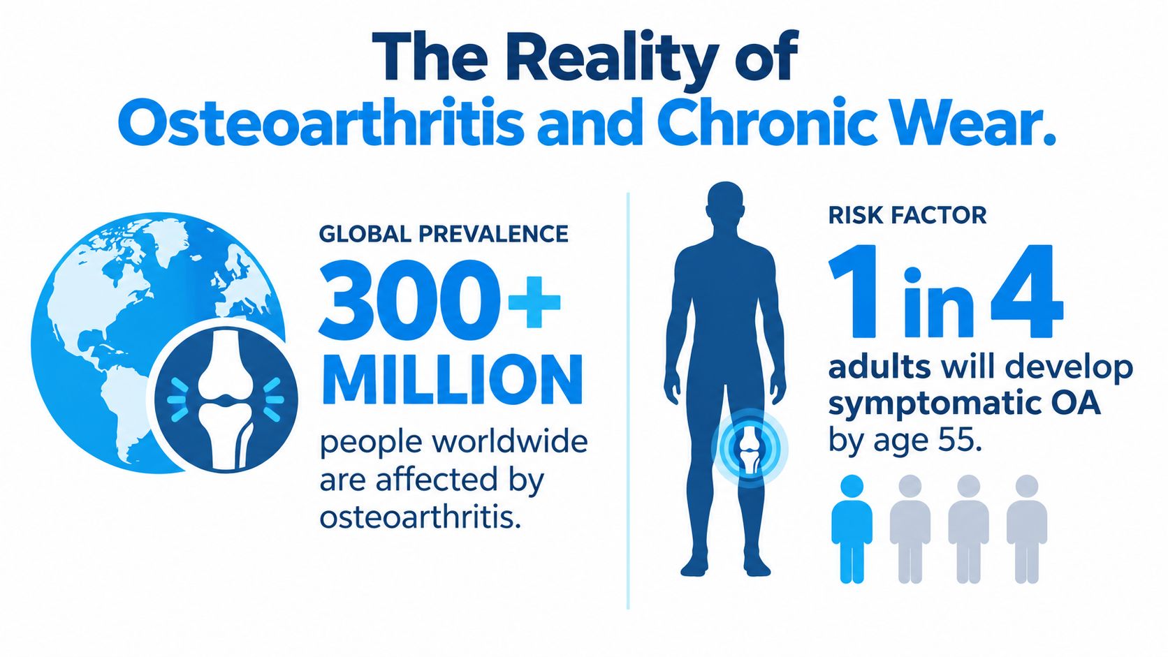 An infographic showing the global prevalence of osteoarthritis, noting over 300 million cases and a one in four risk by age 55.